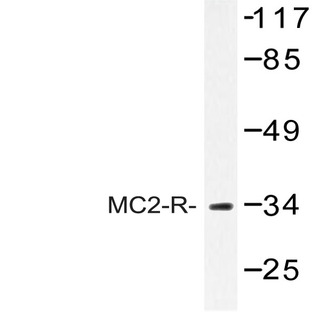 MC2-R (K289) pAb