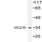 MC2-R (K289) pAb