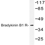 Bradykinin B1 R (R239) pAb