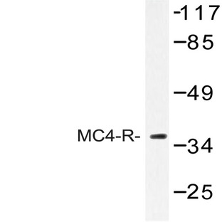 MC4-R (E315) pAb