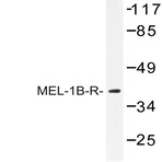 MEL-1B-R (V39) pAb