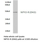 NPY2-R (D42) pAb