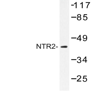 NTR2 (D184) pAb