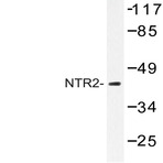 NTR2 (D184) pAb