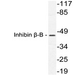 Inhibin (beta)-B (P124) pAb