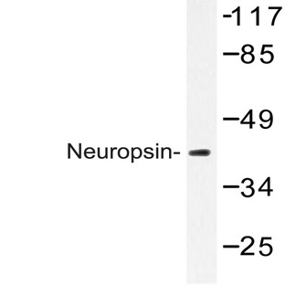 Neuropsin (Q286) pAb