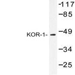 KOR-1 (R361) pAb