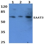 Bs2875_wb