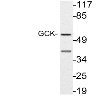 GCK (R43) pAb