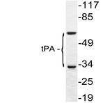 tPA (Q38) pAb