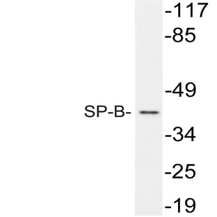 SP-B (W292) pAb