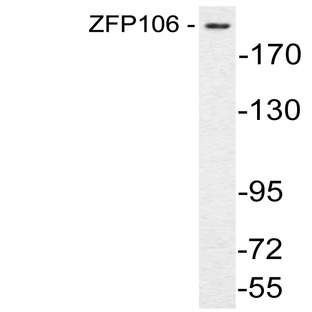 ZFP106 (D1882) pAb