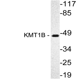 KMT1B (H150) pAb