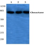 Choactase (R383) pAb