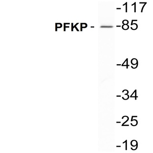 PFKP (E369) pAb