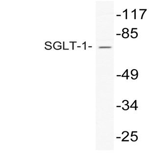 SGLT-1 (D574) pAb