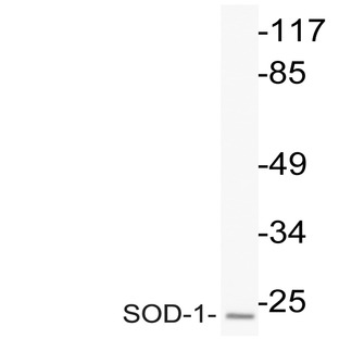 SOD1 (L85) pAb