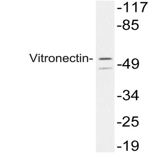 Vitronectin (L258) pAb