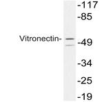 Vitronectin (L258) pAb