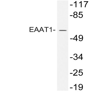 EAAT1 (K541) pAb