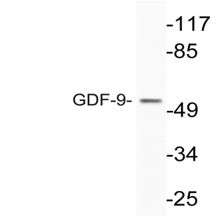 GDF-9 (E322) pAb