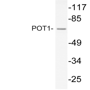 POT1 (N296) pAb