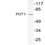 POT1 (N296) pAb