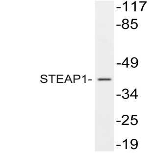 STEAP1 (D31) pAb