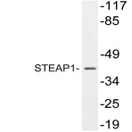 STEAP1 (D31) pAb