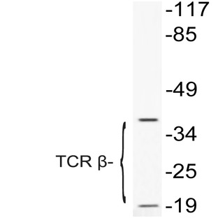 TCR (beta) (K115) pAb