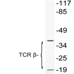 TCR (beta) (K115) pAb