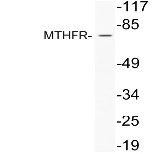 MTHFR (R363) pAb