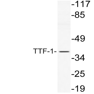 TTF-1 (V27) pAb