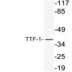 TTF-1 (V27) pAb