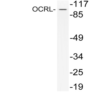 OCRL (Q199) pAb