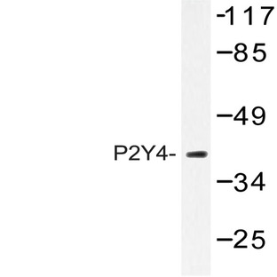 P2Y4 (V198) pAb