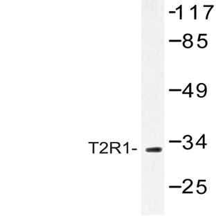 T2R1 (D45) pAb