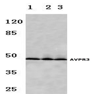 AVP Receptor V3 (D314) pAb