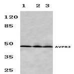 AVP Receptor V3 (D314) pAb