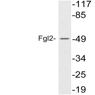 Fgl2 (V38) pAb