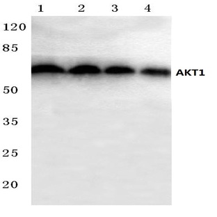 AKT1 (P125) pAb