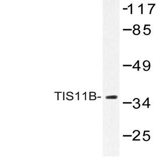 TIS11B (D88) pAb