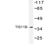 TIS11B (D88) pAb