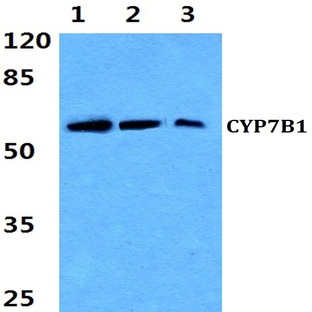 CYP7B1 (Q127) pAb