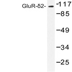 GluR-(delta)2 (G860) pAb