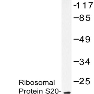 RPS20 (K67) pAb