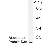 RPS20 (K67) pAb