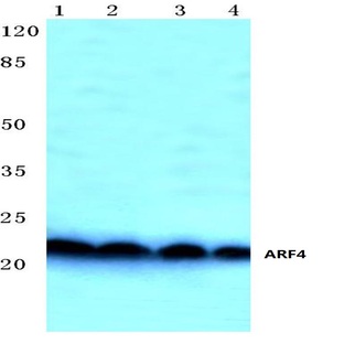 ARF4 (E106) pAb