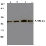 AKR1B1 (K275) pAb