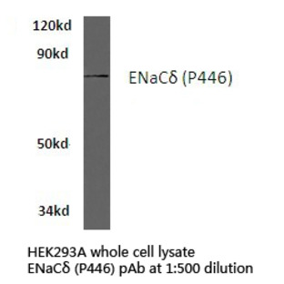 ENaC(delta) (P446) pAb